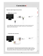 Preview for 11 page of Xtreamer DVD Media Player User Manual