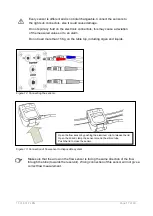 Preview for 17 page of XVIVO 11.01.201 Instructions For Use Manual