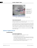 Предварительный просмотр 78 страницы Zeiss CIRRUS HD-OCT 500 User Manual