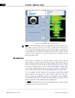 Preview for 84 page of Zeiss CIRRUS HD-OCT 500 User Manual