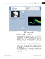 Предварительный просмотр 85 страницы Zeiss CIRRUS HD-OCT 500 User Manual