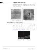 Предварительный просмотр 116 страницы Zeiss CIRRUS HD-OCT 500 User Manual