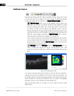 Предварительный просмотр 132 страницы Zeiss CIRRUS HD-OCT 500 User Manual