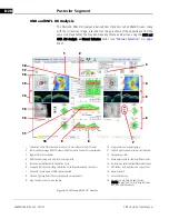 Preview for 150 page of Zeiss CIRRUS HD-OCT 500 User Manual