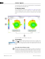 Preview for 166 page of Zeiss CIRRUS HD-OCT 500 User Manual