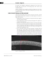 Preview for 174 page of Zeiss CIRRUS HD-OCT 500 User Manual