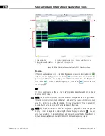 Preview for 178 page of Zeiss CIRRUS HD-OCT 500 User Manual