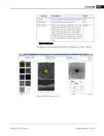 Preview for 207 page of Zeiss CIRRUS HD-OCT 500 User Manual