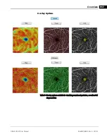 Preview for 211 page of Zeiss CIRRUS HD-OCT 500 User Manual