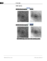 Предварительный просмотр 212 страницы Zeiss CIRRUS HD-OCT 500 User Manual