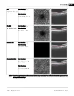 Предварительный просмотр 219 страницы Zeiss CIRRUS HD-OCT 500 User Manual