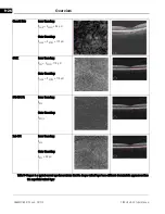 Предварительный просмотр 220 страницы Zeiss CIRRUS HD-OCT 500 User Manual