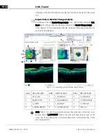 Preview for 250 page of Zeiss CIRRUS HD-OCT 500 User Manual