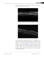 Предварительный просмотр 313 страницы Zeiss CIRRUS HD-OCT 500 User Manual