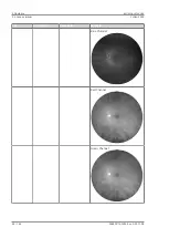 Preview for 64 page of Zeiss CLARUS 500 Instructions For Use Manual