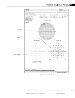 Предварительный просмотр 151 страницы Zeiss Humphrey II-i series User Manual