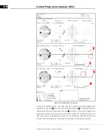 Preview for 176 page of Zeiss Humphrey II-i series User Manual