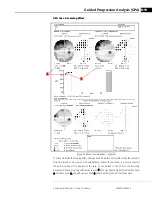 Preview for 177 page of Zeiss Humphrey II-i series User Manual