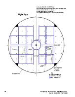 Предварительный просмотр 52 страницы Zeiss Humphrey matrix User Manual