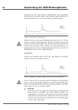 Preview for 66 page of Zeiss IOLMaster User Manual