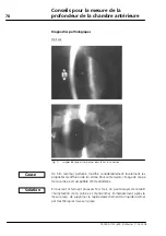 Предварительный просмотр 262 страницы Zeiss IOLMaster User Manual