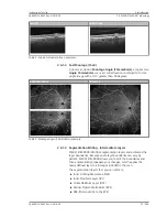 Предварительный просмотр 35 страницы Zeiss PLEX Elite 9000 Instructions For Use Manual