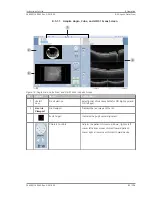 Preview for 83 page of Zeiss PLEX Elite 9000 Instructions For Use Manual