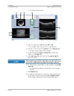 Preview for 86 page of Zeiss PLEX Elite 9000 Instructions For Use Manual