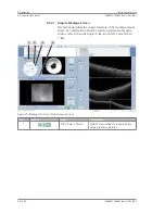 Preview for 92 page of Zeiss PLEX Elite 9000 Instructions For Use Manual