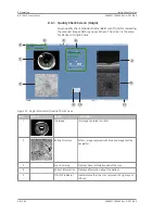 Preview for 98 page of Zeiss PLEX Elite 9000 Instructions For Use Manual