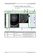 Preview for 108 page of Zeiss PLEX Elite 9000 Instructions For Use Manual