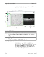 Preview for 114 page of Zeiss PLEX Elite 9000 Instructions For Use Manual