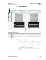 Preview for 117 page of Zeiss PLEX Elite 9000 Instructions For Use Manual