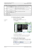 Предварительный просмотр 120 страницы Zeiss PLEX Elite 9000 Instructions For Use Manual