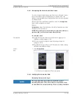 Preview for 121 page of Zeiss PLEX Elite 9000 Instructions For Use Manual