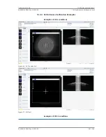 Preview for 201 page of Zeiss PLEX Elite 9000 Instructions For Use Manual