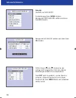 Предварительный просмотр 17 страницы Zeiss Victory DC4 Instructions For Use Manual