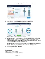 Предварительный просмотр 31 страницы ZELTIQ CoolSculpting Elite User Manual