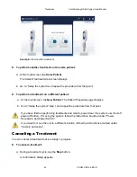 Предварительный просмотр 34 страницы ZELTIQ CoolSculpting Elite User Manual