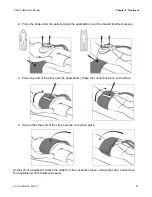 Preview for 27 page of ZELTIQ COOLTONE User Manual