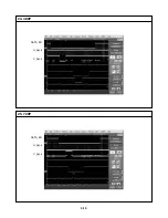 Предварительный просмотр 22 страницы Zenith DVB318 Service Manual