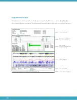 Preview for 56 page of Zephyr Sleep Technologies MATRx plus Healthcare Provider Manual