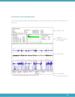 Preview for 59 page of Zephyr Sleep Technologies MATRx plus Healthcare Provider Manual