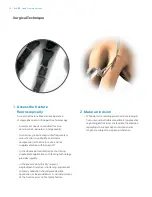 Preview for 20 page of Zimmer Biomet A.L.P.S. Surgical Technique