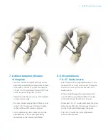 Preview for 23 page of Zimmer Biomet A.L.P.S. Surgical Technique