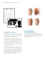 Preview for 4 page of Zimmer Biomet Arcos Modular FemoralRevision System Surgical Technique