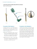 Preview for 6 page of Zimmer Biomet Arcos Modular FemoralRevision System Surgical Technique