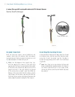 Preview for 18 page of Zimmer Biomet Arcos Modular FemoralRevision System Surgical Technique