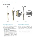 Preview for 28 page of Zimmer Biomet Arcos Modular FemoralRevision System Surgical Technique