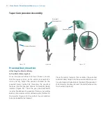 Preview for 30 page of Zimmer Biomet Arcos Modular FemoralRevision System Surgical Technique